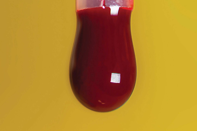 A drop of blood