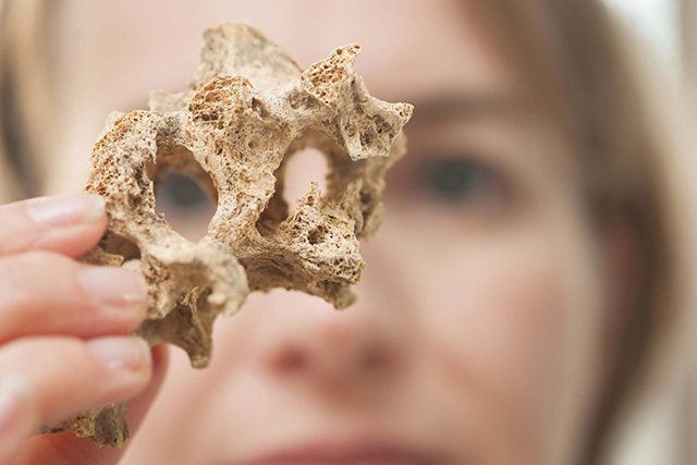 Examining a vertebra 